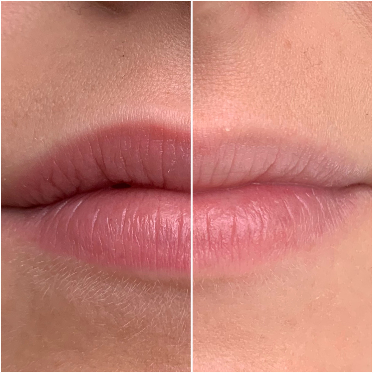 Lippenpigmentierung: Deine Lippen, Deine Farbe, Deine Perfektion